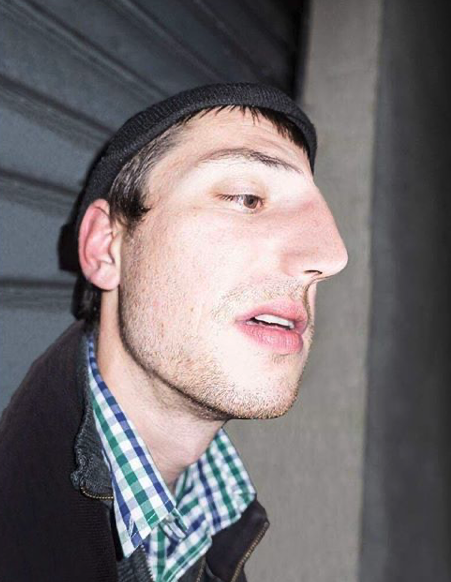 man with large nose