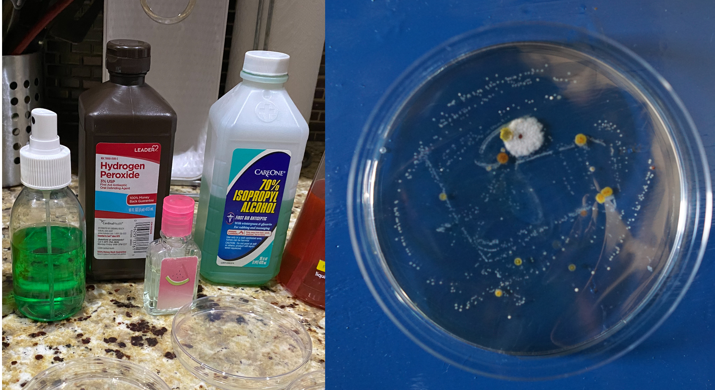 Does Hand Sanitizer Actually Work? A Disgusting Science Experiment